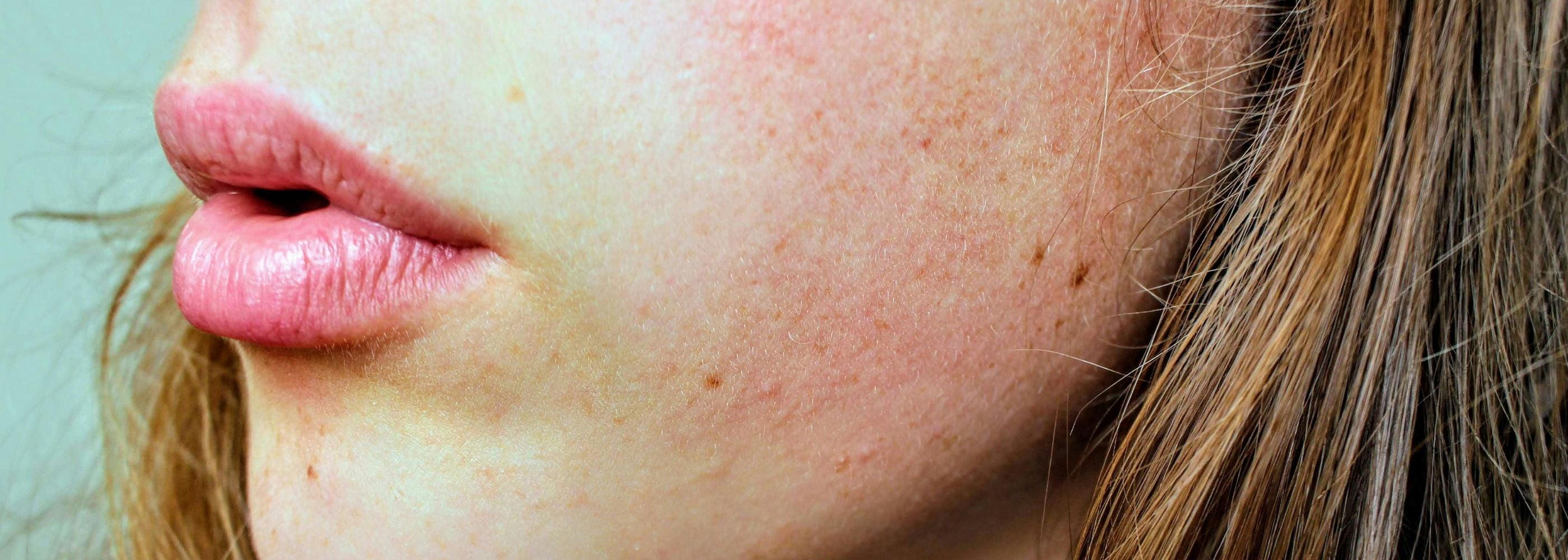 Sensitive Skin