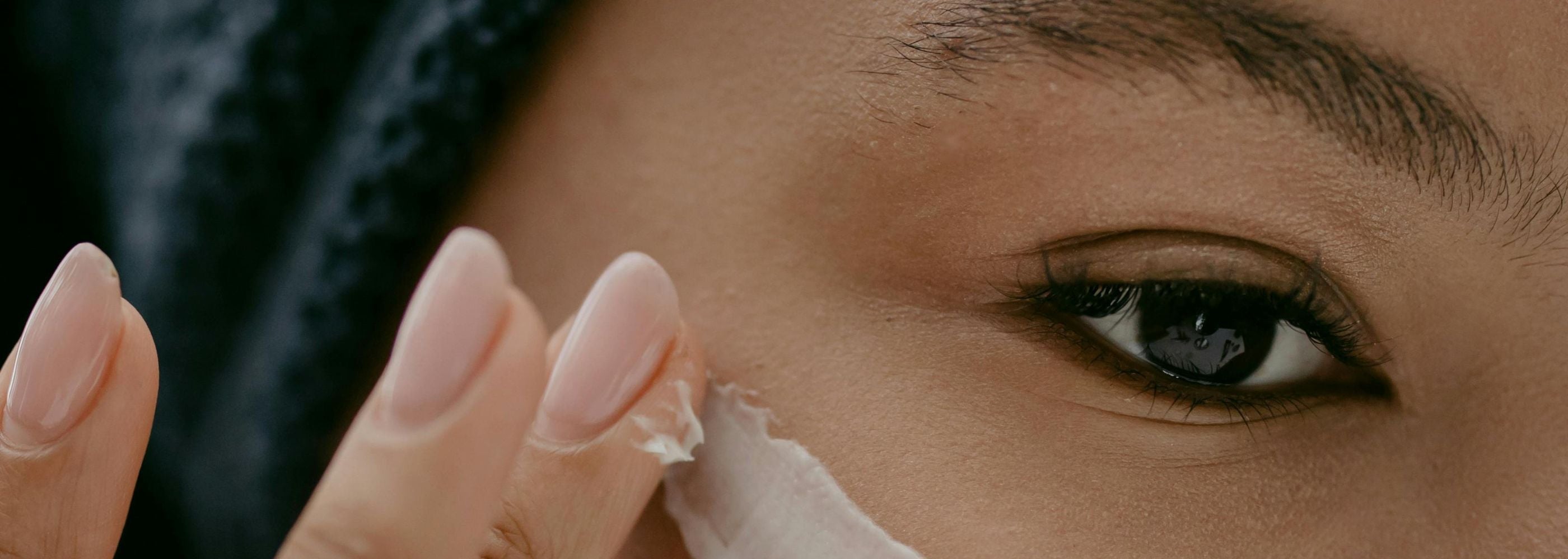 Dry Skin
